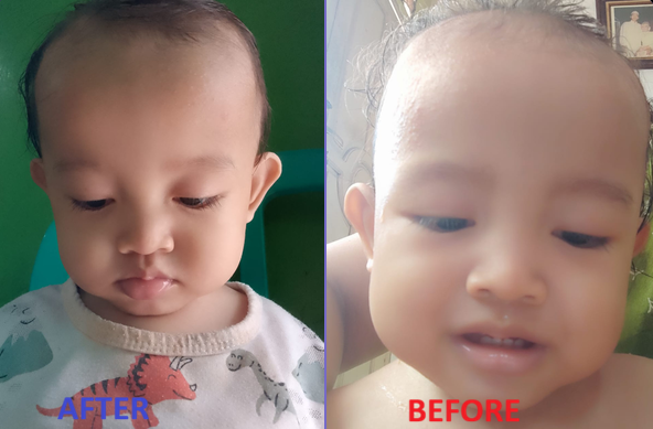 Sebelum dan sesudah — Reni